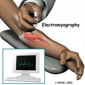 Fisioterapia y electromiografía en patología neuromuscular 4 2024